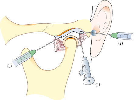Minimally Invasive Therapy